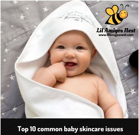 Top 10 common baby skin care issues